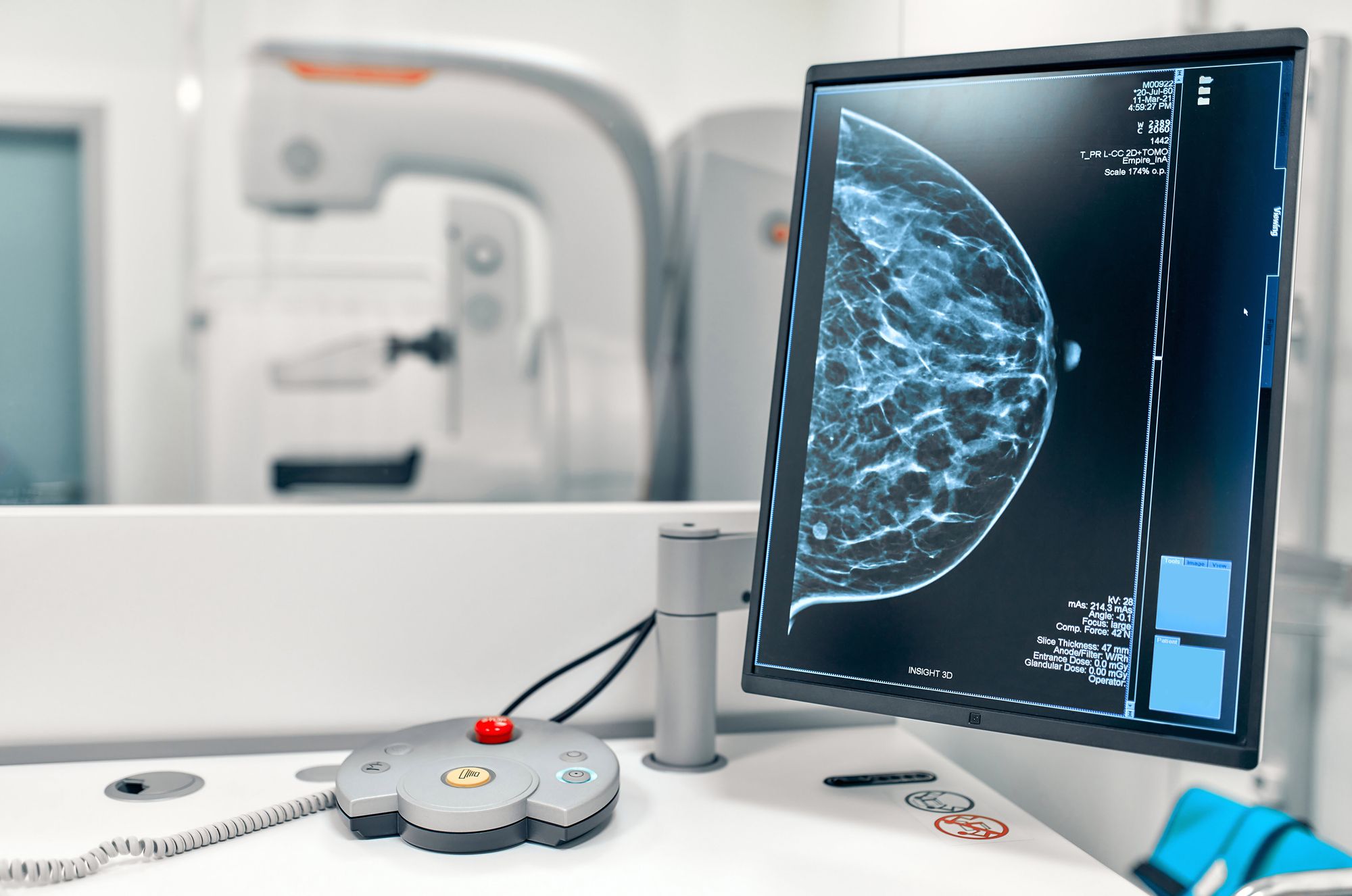 What is a Mammogram?
