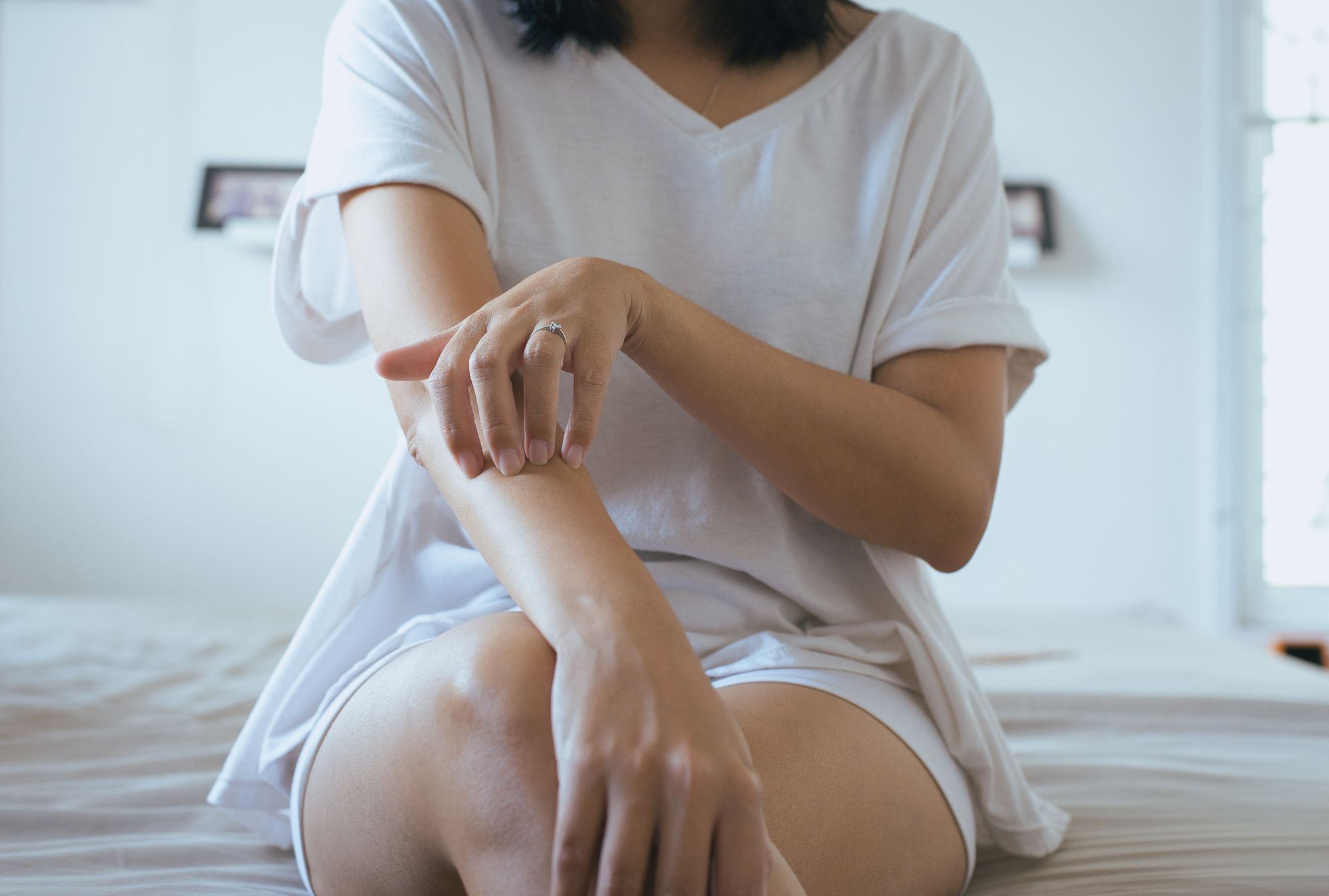 6 Different Types of Eczema
