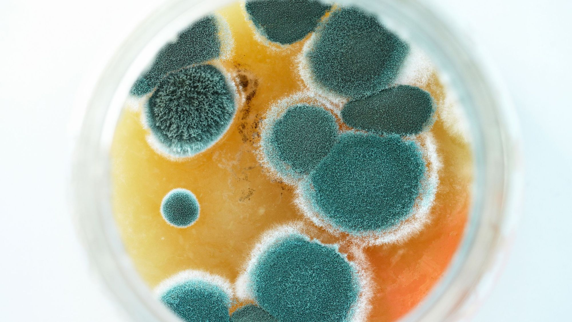 Mold Exposure Symptoms: 10 Signs You May Have Been Exposed to Water Damage or Mold