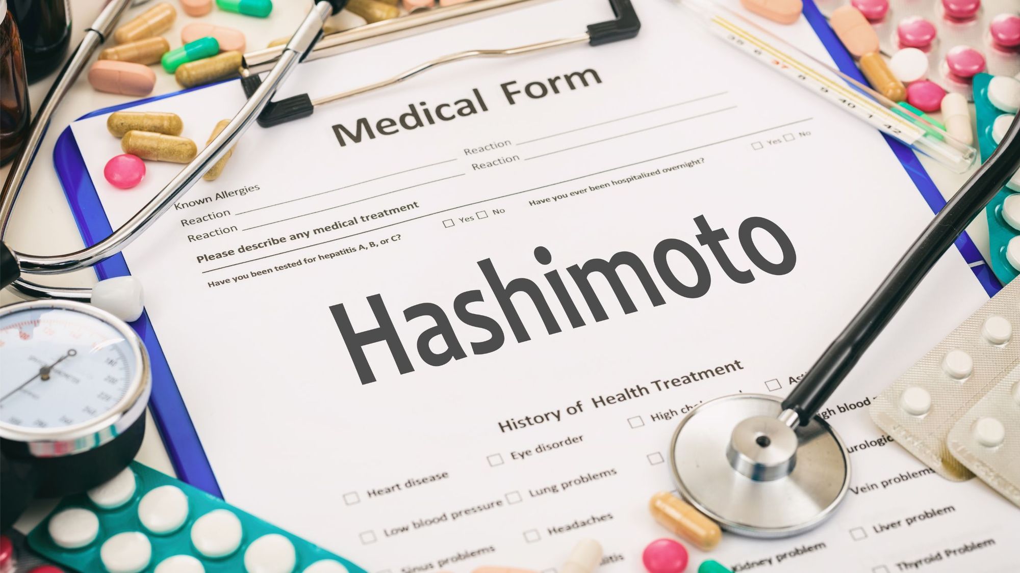 Hashimoto’s Disease: Causes, Signs, Symptoms, Treatments