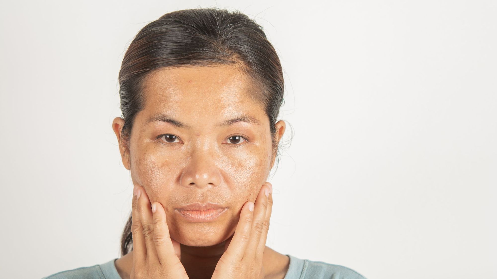 The Myth of Spot Reduction: Why it Doesn’t Work