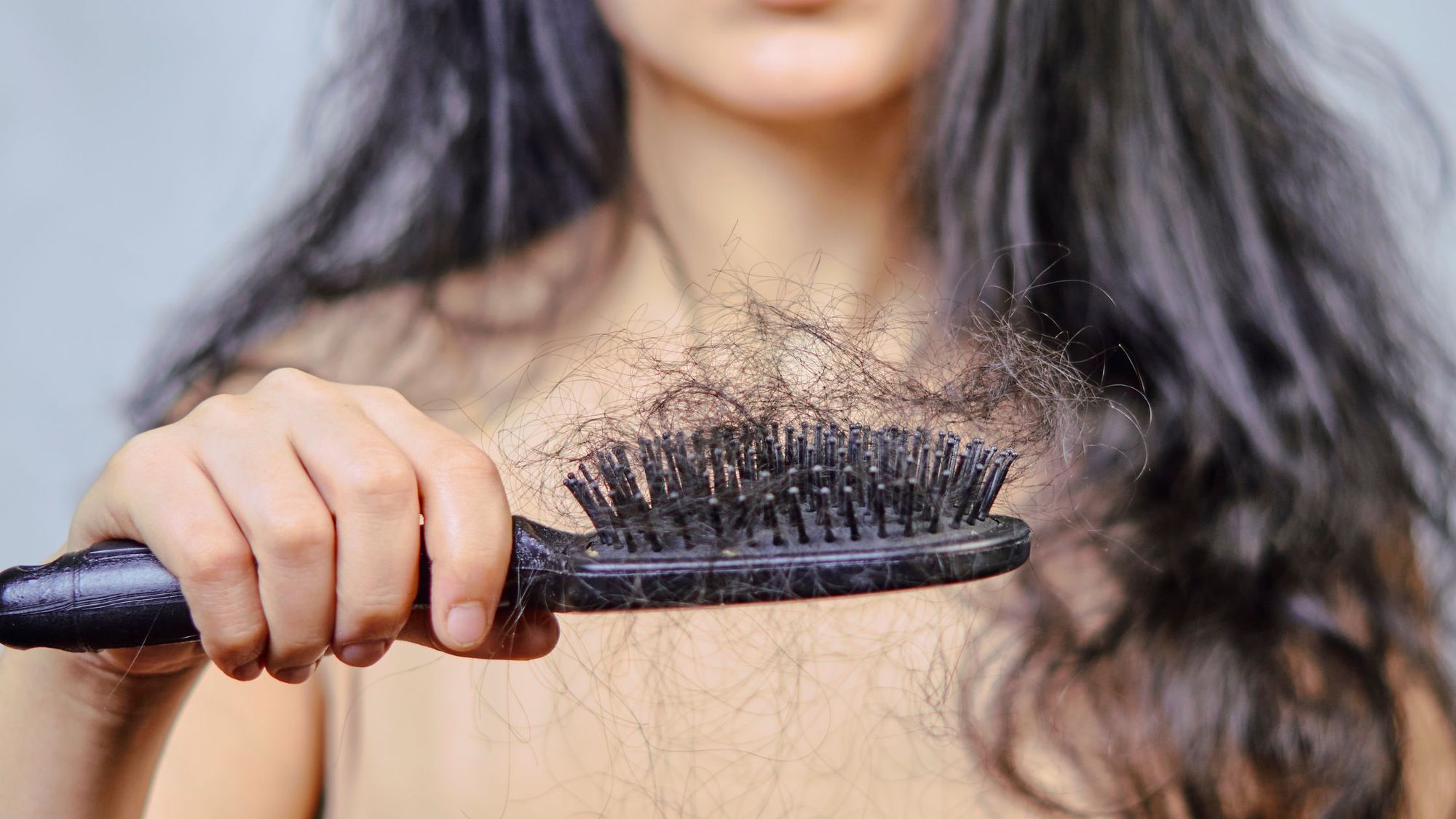 3 Common Hair Health Problems With Easy Solutions