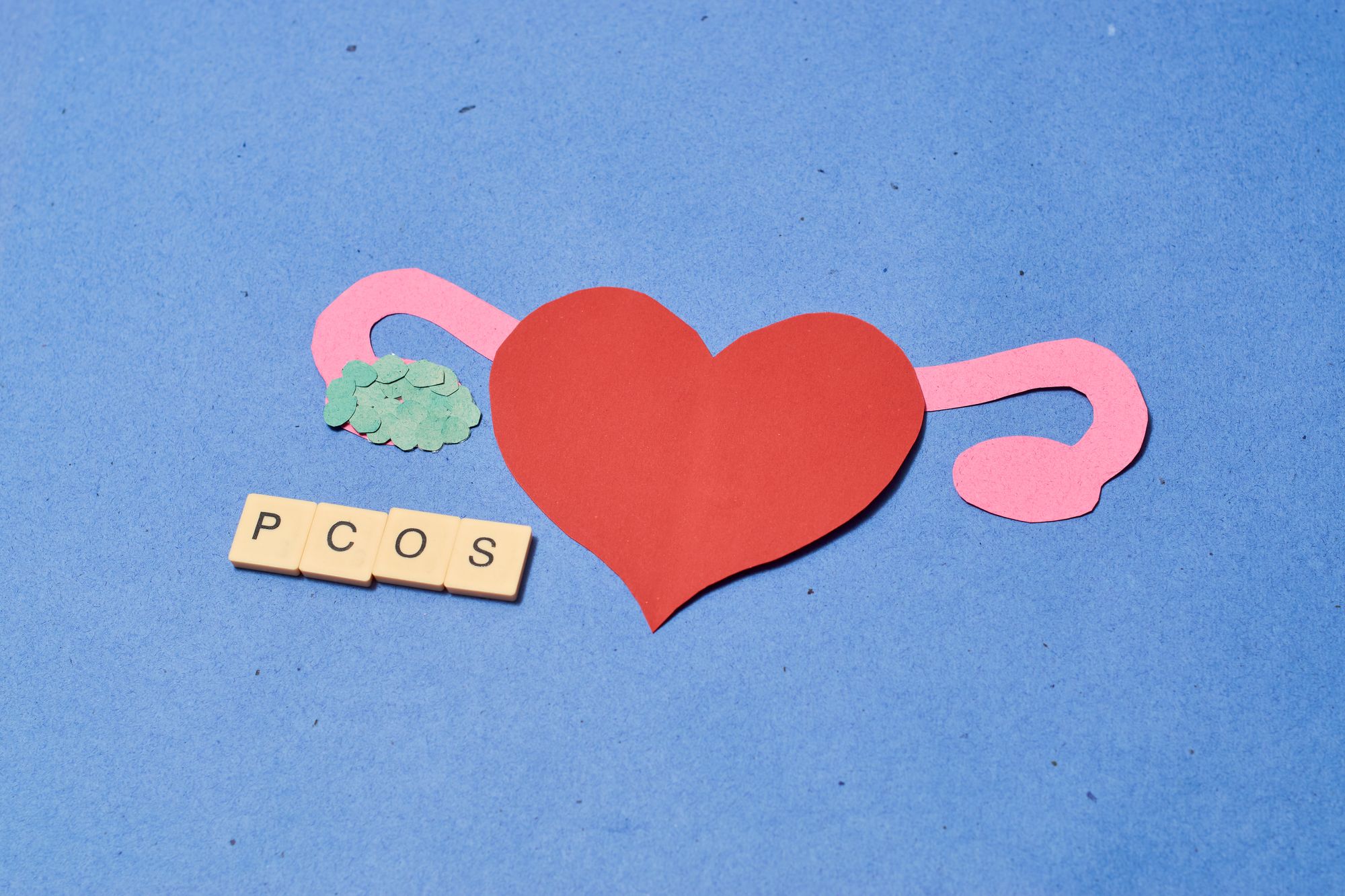 Do You Have PCOS? The Common Disorder That Goes Unnoticed