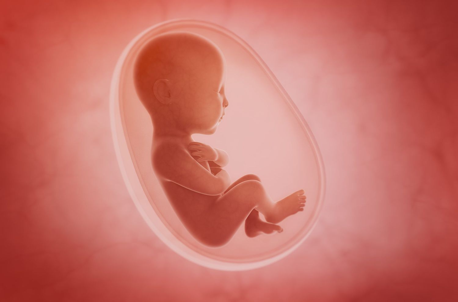 What is GRACILE Syndrome? Key Insights for Parents