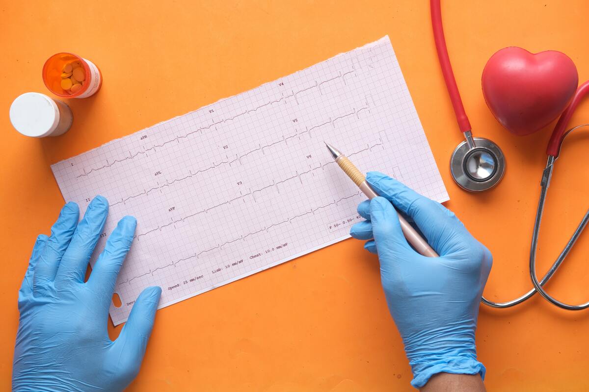 Heart Attack: Signs, Symptoms, Causes and Treatment