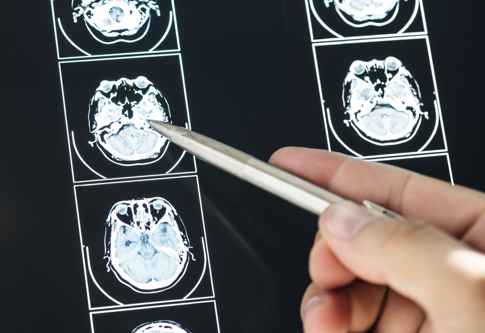 Which Types Of Cancer Are Most Common For Young Adults?